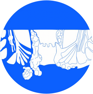 Laser-surgery-for-piles-fistula-fissure